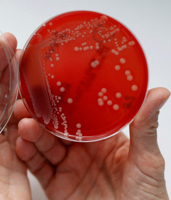FDA: Antibiotikët e rinj në terapinë kundër Staphylococcus aureus